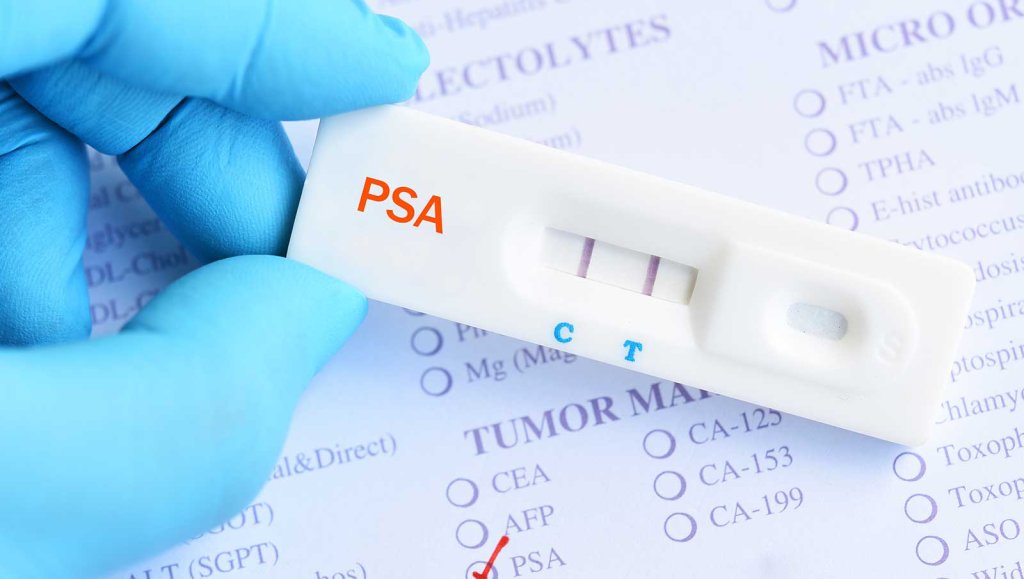 東京八重洲クリニックの前立腺ドック