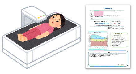 骨密度測定検査の流れと結果