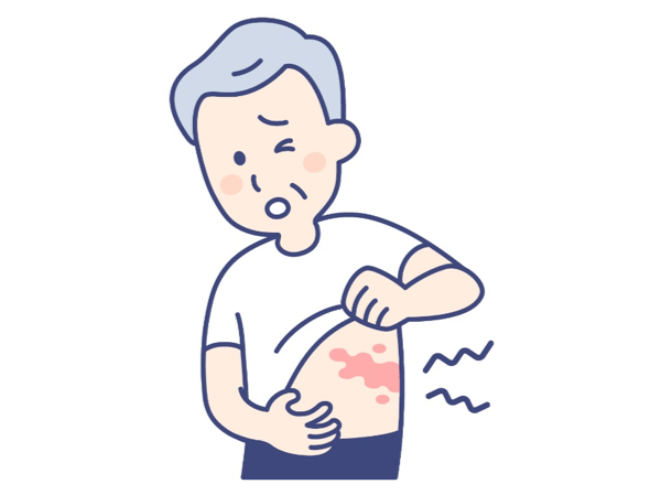 帯状疱疹の痛みについて