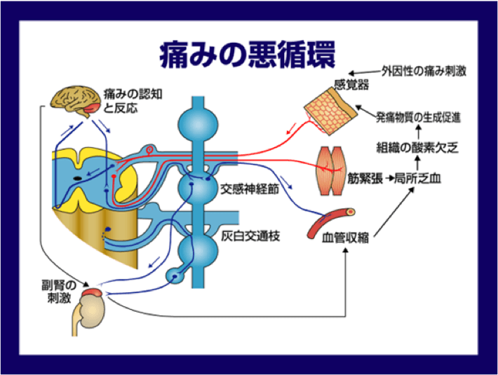 痛みの悪循環