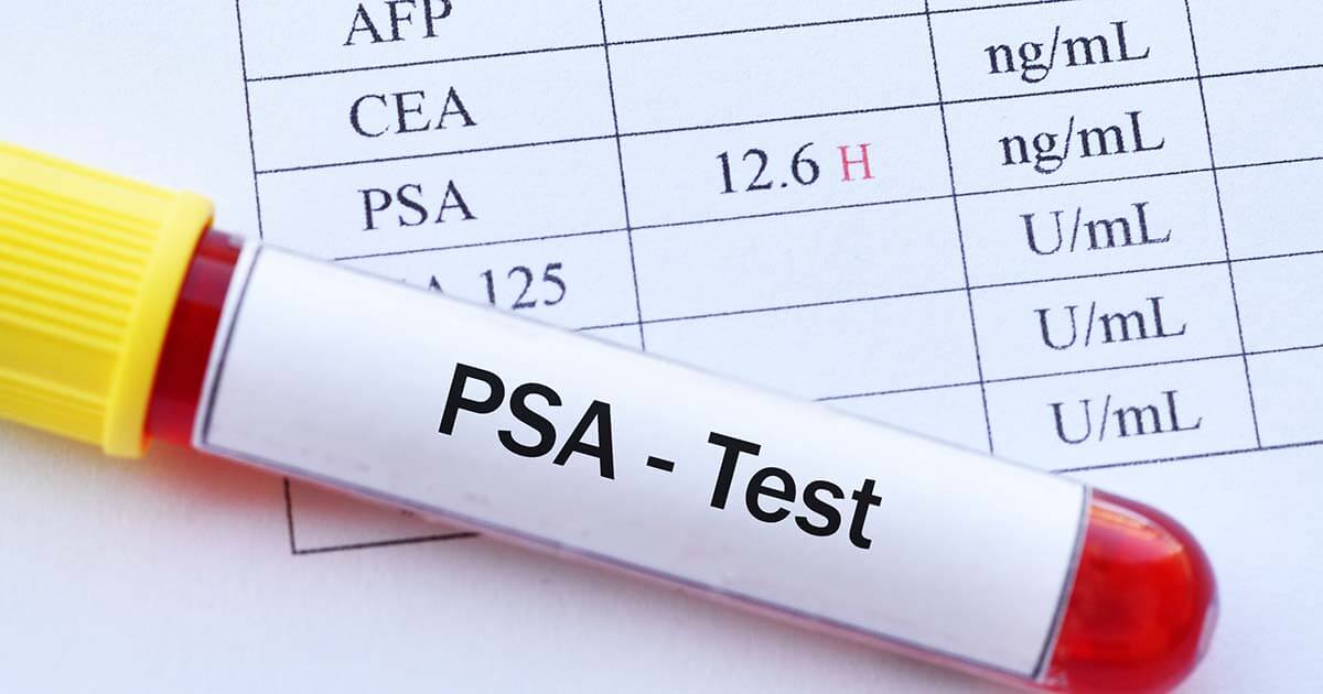 S2,3PSA%測定開始のお知らせ
